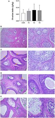 Effects of zearalenone on ovarian development of prepubertal gilts through growth hormone axis